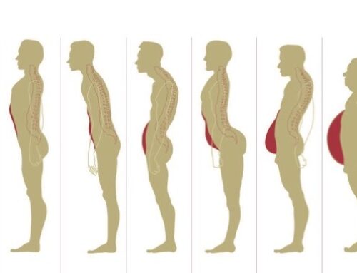 Woher können Rückenschmerzen und Schulter- Nackenschmerzen kommen? 